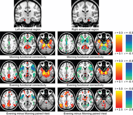 Morning-evening variation in human brain metabolism and memory circuits